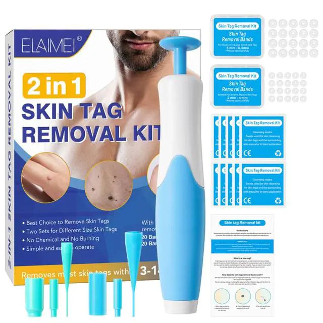 Skin Tag Remover Kit: Micro Removal Device