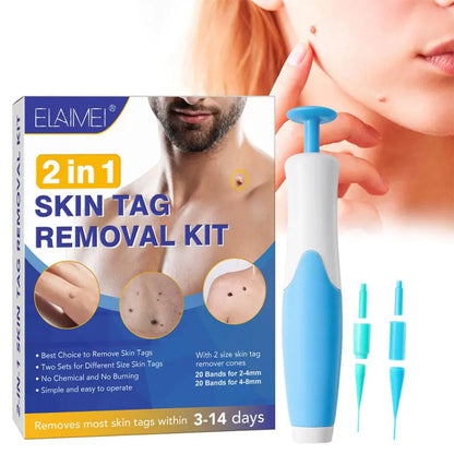 Skin Tag Remover Kit: Micro Removal Device