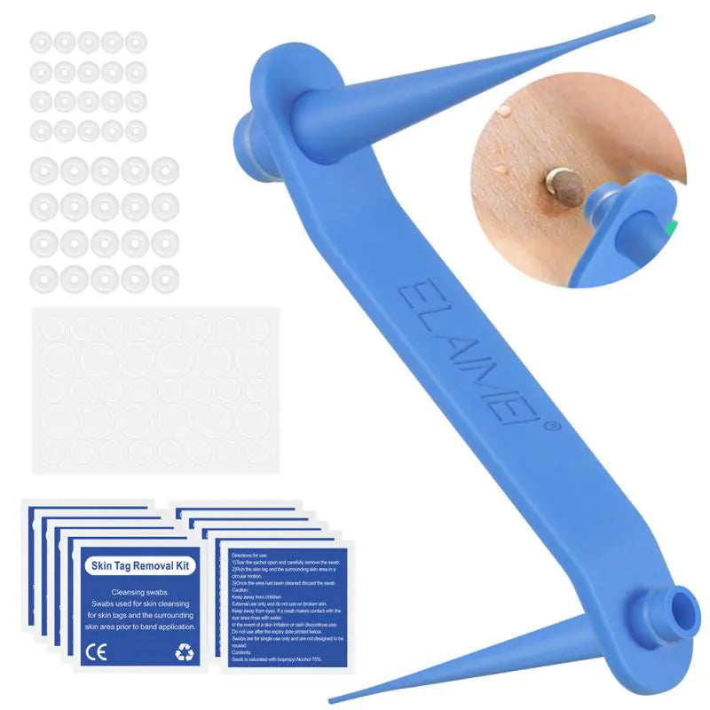 Skin Tag Remover Kit: Micro Removal Device