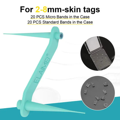 Skin Tag Remover Kit: Micro Removal Device