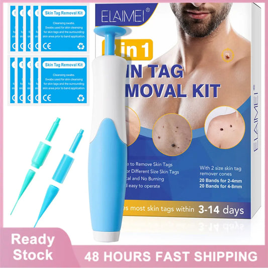 Skin Tag Remover Kit: Micro Removal Device